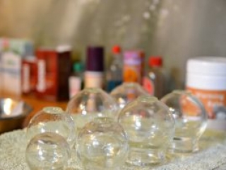 Chinese Acupuncture and Massage - Brisbane