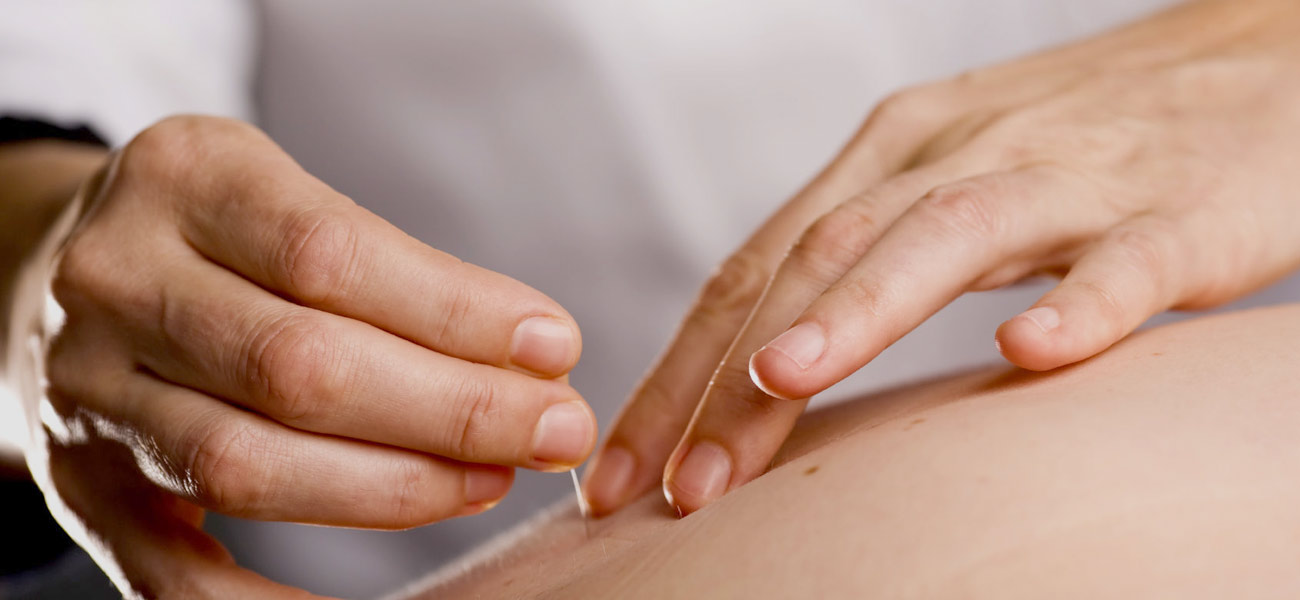 Acupuncture Brisbane